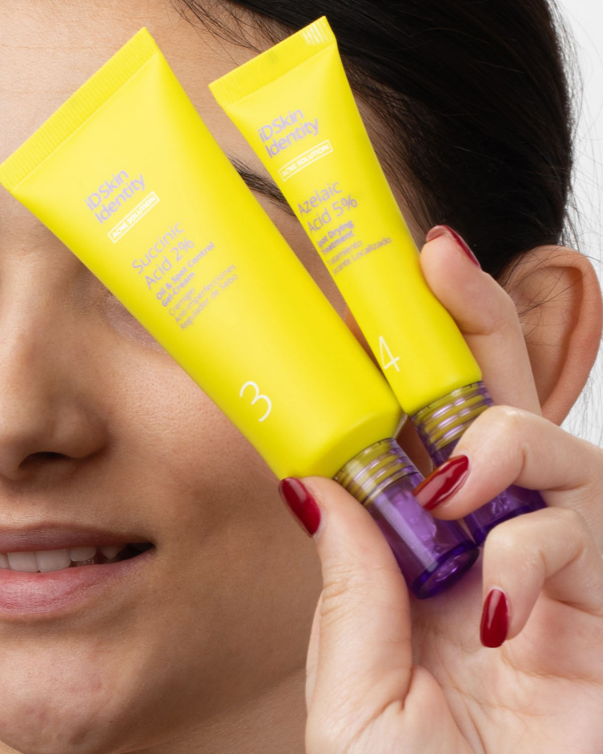 Drying treatment with 5% azelaic acid